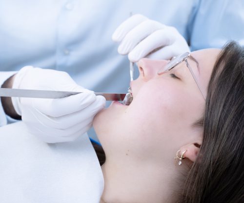 Kieferorthopäde Wittmund: Behandlung mit Zahnspange von Dr. Holtkamp