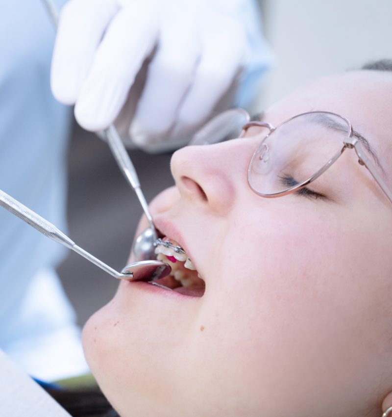 Kieferorthopäde Wittmund: Behandlung von Patientin mit Brackets